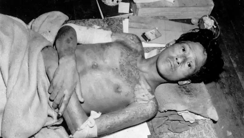 80 Yıl Sonra Nagasaki’den Uyanış: Nükleer Tehdit Hakkında Ne Biliyoruz?