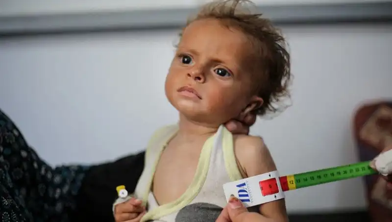 İngiltere, 300 Gazze'li Çocuğa Acil Yardım İmkanı Sunacak